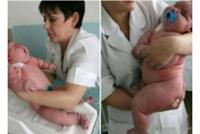  إمرأة تزن 300 كيلو تضع مولودها الأول!
