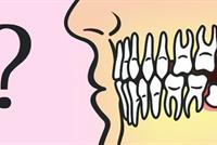 خبر غير سارّ للذين استأصلوا ضرس العقل!